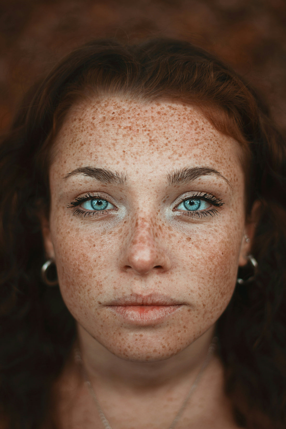 Understanding Hyperpigmentation – Part 2: When Are You Most Vulnerable?