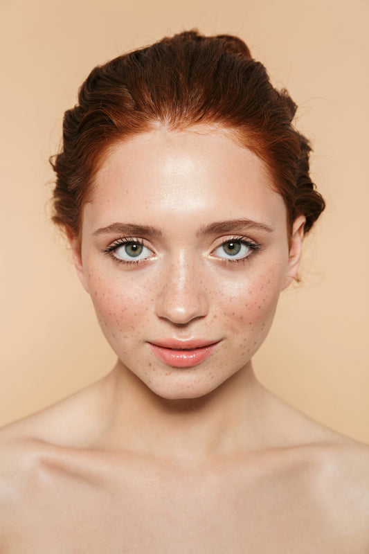 Understanding Hyperpigmentation – How to Fade Dark Spots Naturally